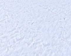 冰雪贴图09201360